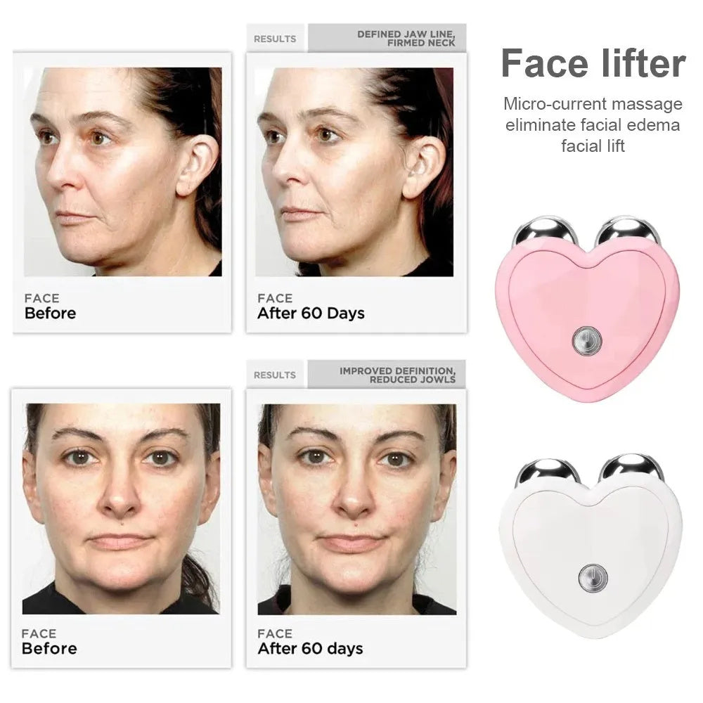 Health & Beauty - EMS Face Lifting Machine Facial Massager Microcurrent Roller